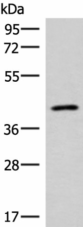 Western blot analysis of Human abdominal interstitial sarcoma tissue lysate  using SLC16A7 Polyclonal Antibody at dilution of 1:400