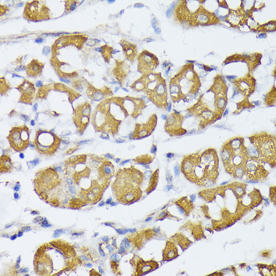 Immunohistochemistry of paraffin-embedded Human stomach using VAPA Polyclonal Antibody at dilution of 1:100 (40x lens).