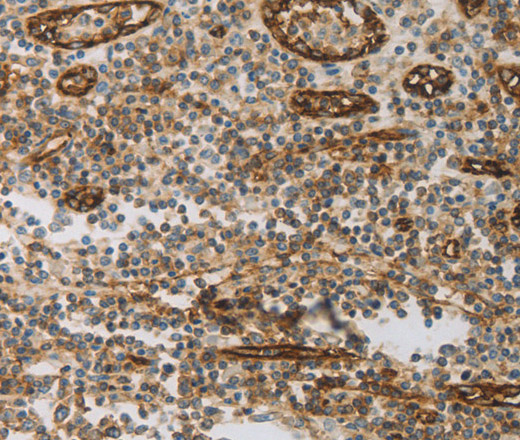 Immunohistochemistry of paraffin-embedded Human tonsil using CD31 Polyclonal Antibody at dilution of 1:30