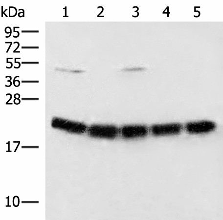 Western blot analysis of Raji cell Mouse brain tissue Hela A375 and 231 cell lysates  using ARF5 Polyclonal Antibody at dilution of 1:400