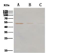 Western Blot analysis of Recombinant MERS-CoV Nucleoprotein / NP protein (His Tag)(PKSV030235 with 500ng, 200ng and 100ng ) using Anti-MERS-CoV Nucleocapsid Protein Polyclonal Antibody at dilution of 1:1000.