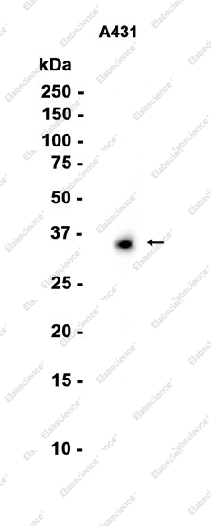 Recombinant Tartrate Resistant Acid Phosphatase Monoclonal Antibody - 1
