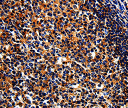 Immunohistochemistry of paraffin-embedded Human tonsil tissue using BIRC6 Polyclonal Antibody at dilution 1:50