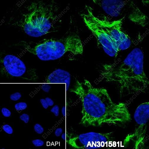 Recombinant Keratin 5/6 Monoclonal Antibody - 7