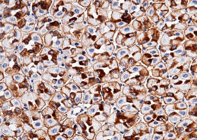 Recombinant EpCAM/TROP-1/TACSTD1 Monoclonal Antibody - small - 2