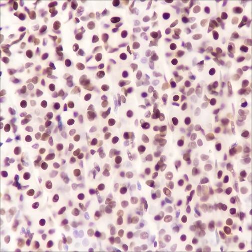 Recombinant FUBP1 Monoclonal Antibody - small - 5
