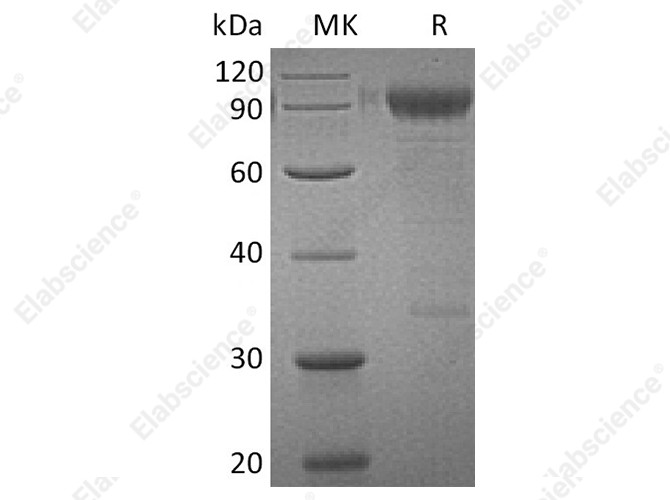 Recombinant Human IL3RA/CD123 Protein (Fc Tag) - 1