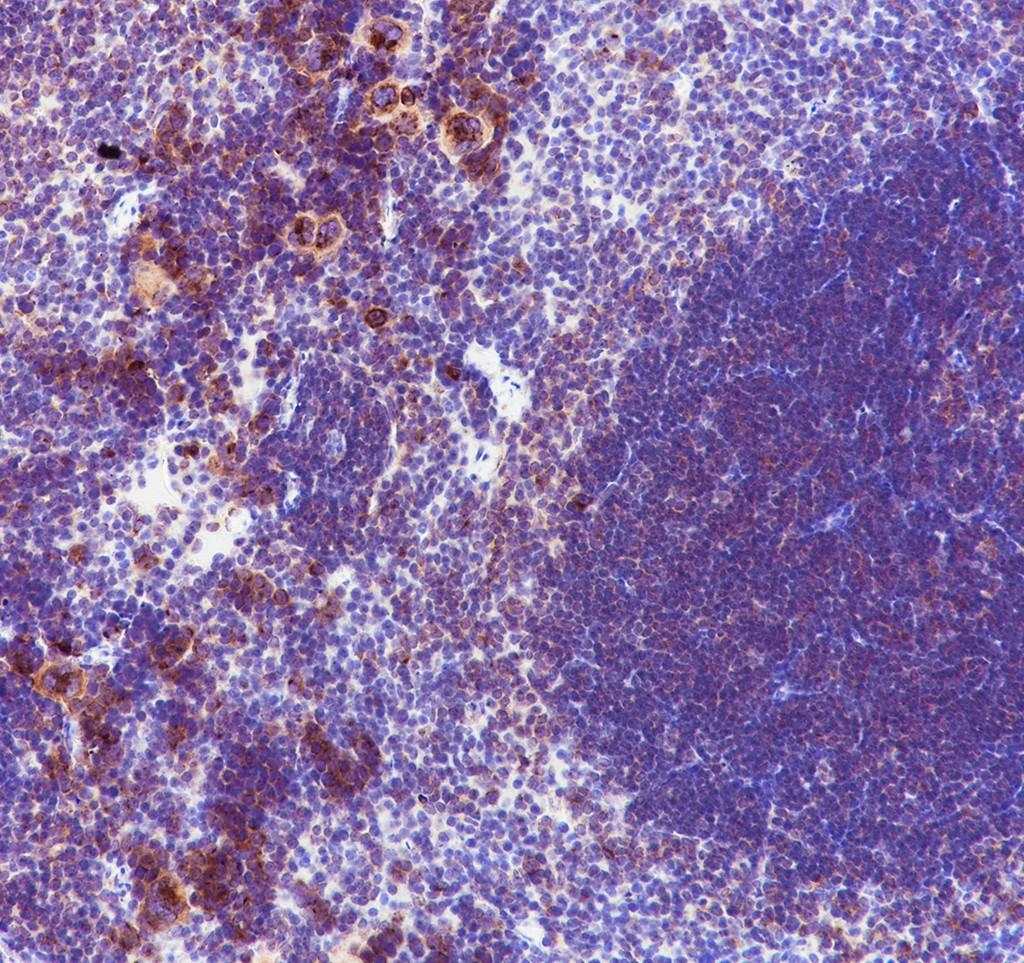 Recombinant GOLGA2/GM130 Monoclonal Antibody - small - 4