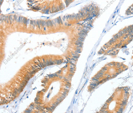 ACY3 Polyclonal Antibody - 3
