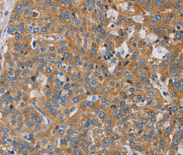 ACTN4 Polyclonal Antibody - 2