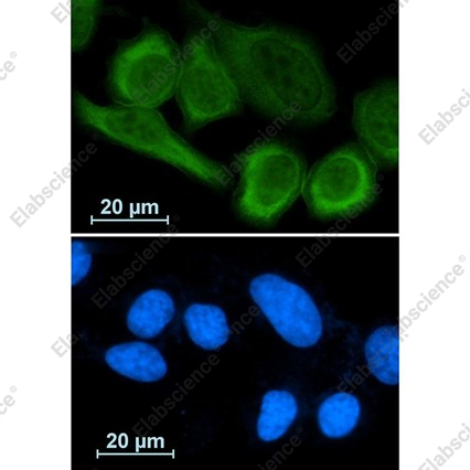 Recombinant Annexin A1 Monoclonal Antibody - 3