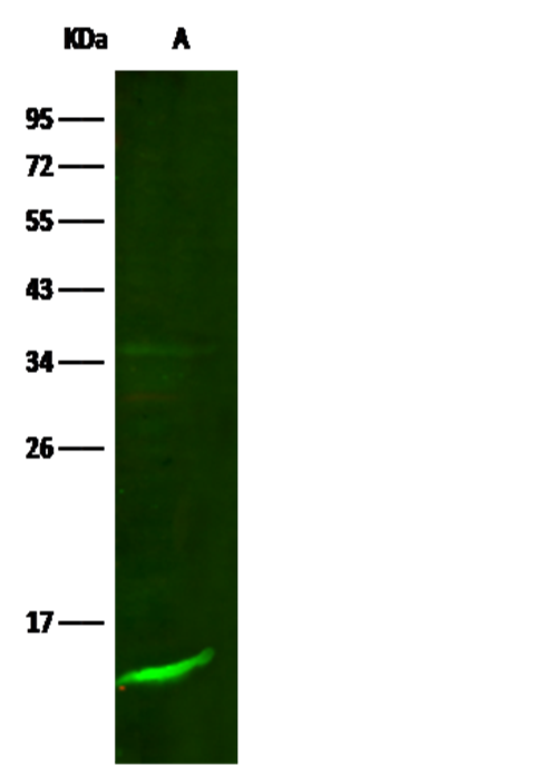 Recombinant B2M/beta-2 microglobulin Monoclonal Antibody
