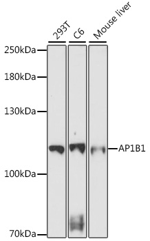 Western blot analysis of extracts of various cell lines using AP1B1 Polyclonal Antibody at 1:1000 dilution.