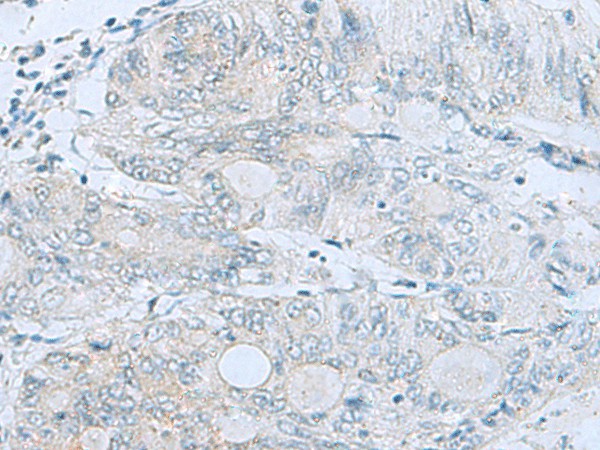 MGME1 Polyclonal Antibody - small - 2