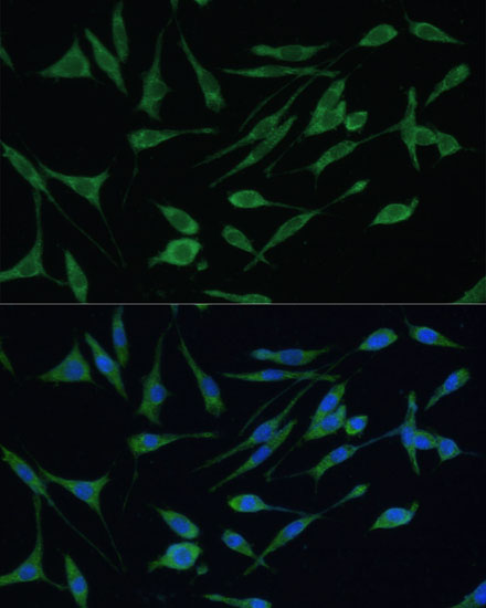 Immunofluorescence analysis of L929 cells using ARHGAP25 Polyclonal Antibody at dilution of 1:100 (40x lens). Blue: DAPI for nuclear staining.