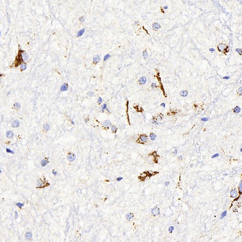 Immunohistochemistry analysis of paraffin-embedded rat spinal marrow  using DLL1 Polyclonal Antibody at dilution of 1:200.