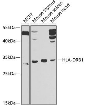 Western blot analysis of extracts of various cell lines using HLA-DRB1 Polyclonal Antibody at 1:1000 dilution.