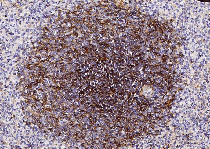 Recombinant CD73/NT5E Monoclonal Antibody-searchlist-1