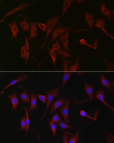 Immunofluorescence analysis of NIH/3T3 cells using PKC zeta Polyclonal Antibody at dilution of 1:100 (40x lens). Blue: DAPI for nuclear staining.