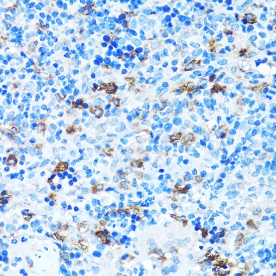 FGFR2 Polyclonal Antibody - small - 4