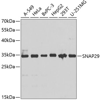 Western blot analysis of extracts of various cell lines using SNAP29 Polyclonal Antibody at 1:1000 dilution.