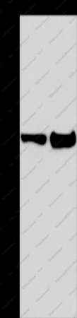 MAPRE3 Polyclonal Antibody - 1