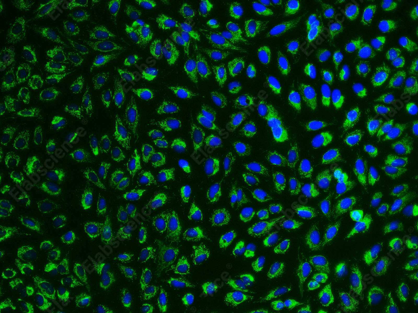 HSP-60 Polyclonal Antibody - 9
