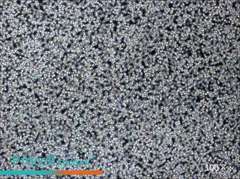 Z-138 Cell Complete Medium - 1