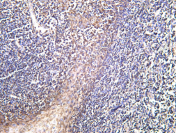 Recombinant TSPO Monoclonal Antibody - 2