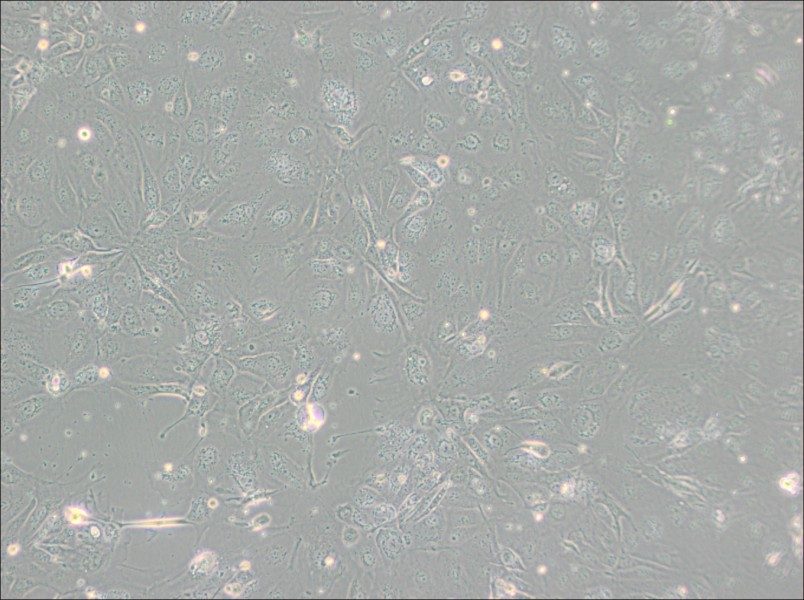 NCI-H2347 Cell Complete Medium - 2