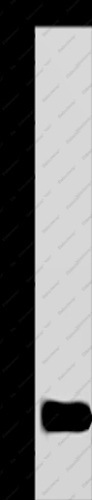 DYNLL1 Polyclonal Antibody - 1