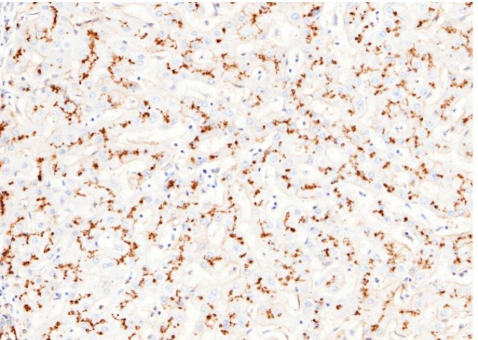 Recombinant CD13/ANPEP Monoclonal Antibody - small - 2