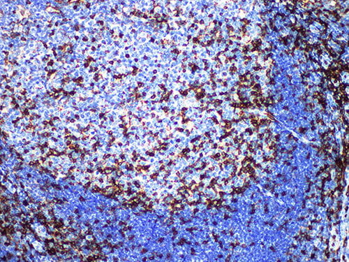 Immunohistochemistry of paraffinembedded Human tonsil tissue with CD43 Monoclonal Antibody(Antigen repaired by EDTA).