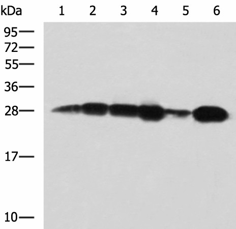 Western blot analysis of 293T cell Human bladder transitional cell carcinoma grade 2-3 tissue lysate MCF-7 cell lysates  using MMAB Polyclonal Antibody at dilution of 1:1400