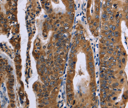 FAF1 Polyclonal Antibody - 3
