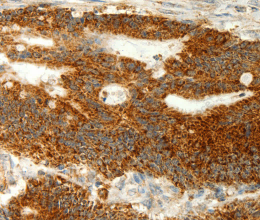 COX7B Polyclonal Antibody - 2