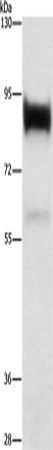 Western Blot analysis of Human prostate tissue using LTF Polyclonal Antibody at dilution of 1:400