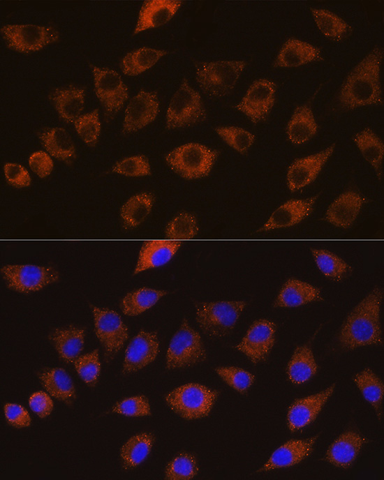 Immunofluorescence analysis of L929 cells using DLG1 Polyclonal Antibody at dilution of 1:100 (40x lens). Blue: DAPI for nuclear staining.