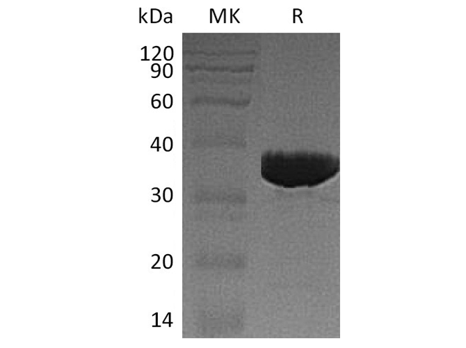 Recombinant Human GALM Protein (His Tag)