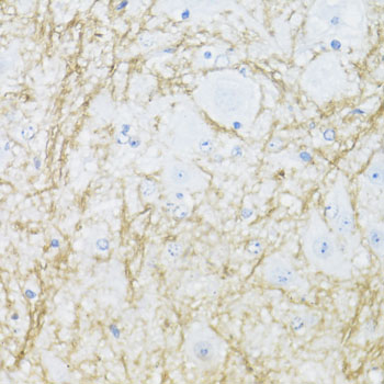 Immunohistochemistry of paraffin-embedded Mouse spinal cord using CNP Polyclonal Antibody at dilution of 1:100 (40x lens).