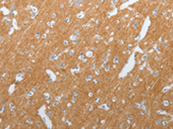 Immunohistochemistry of paraffin-embedded Human brain tissue  using SLC17A7 Polyclonal Antibody at dilution of 1:200(?200)