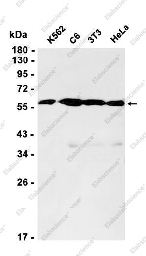 Recombinant Lumican Monoclonal Antibody - 2