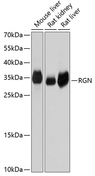 Western blot analysis of extracts of various cell lines using RGN Polyclonal Antibody at dilution of 1:1000.