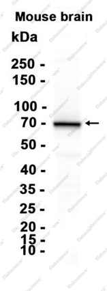Recombinant ATP6V1A Monoclonal Antibody - 2