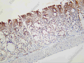 Recombinant CEACAM1 Monoclonal Antibody - 2