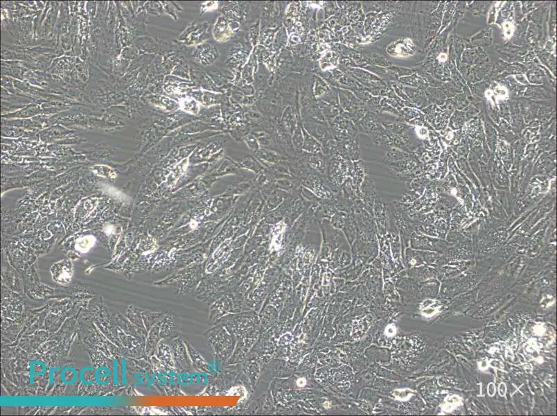 UM-Chor1 Cell Complete Medium - 1