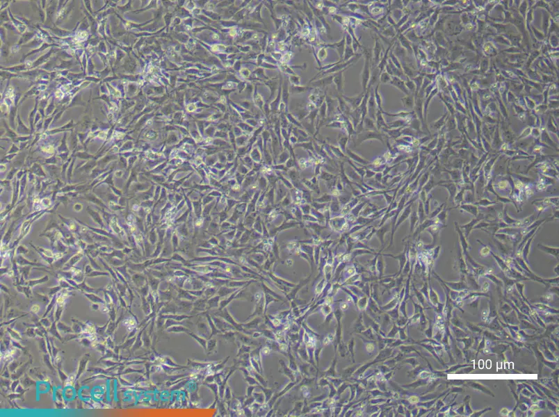 Rat Corpus Cavernosum Smooth Muscle CellsRat Corpus Cavernosum Smooth Muscle Cells - 2