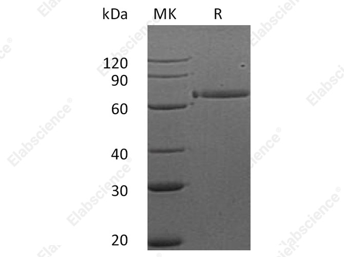 Recombinant Human HER3/ErbB3 Protein (Fc Tag) - 1