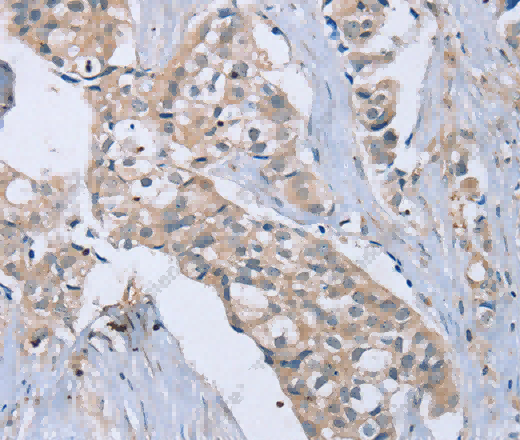 EDA Polyclonal Antibody - 3