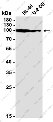 Recombinant Ubiquitin Protein Ligase E3A Monoclonal Antibody - 3